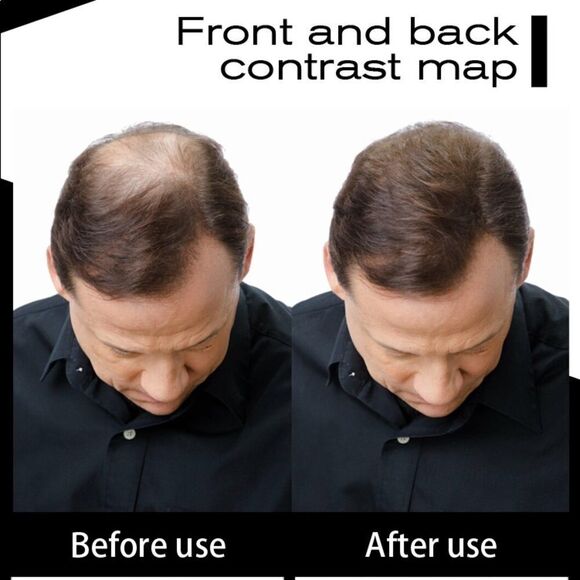 🔥SEVICH Loss Hair Thicken Extension Hair Building Fiber Powder 25g🔥 - Picture 6 of 6